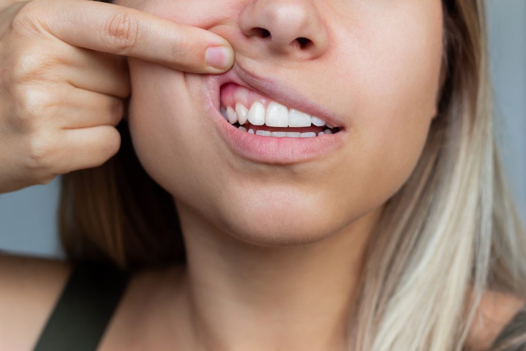 gum-health-closeup-young-woman-showing-healthy-gums-dentistry-dental-care